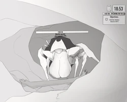 [Lobsteragent12] Beetle Queen got stuck while spawning in.